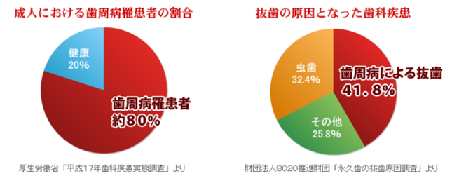 歯周病チャート